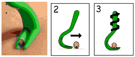 Procedura di estrazione di una zecca