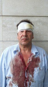 Il giornalista Antonello Lai dopo l'aggressione