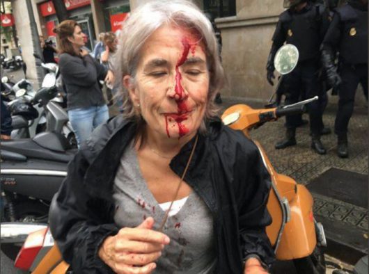 Donna con il viso insaguinato dopo gli scontri con la Polizia 