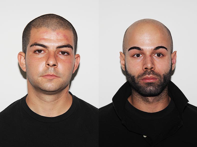 Due arresti per l'accoltellamento di piazza Veneto