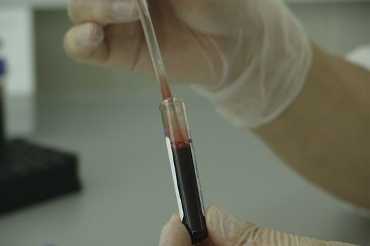 AIDS: dal 1982 a oggi il virus ha causato in Italia 43 mila morti