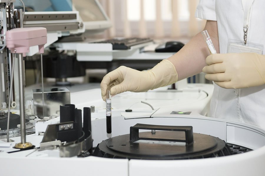 Al Brotzu gli interventi sul cervello si fanno attraverso il naso grazie all’endoscopio 3D