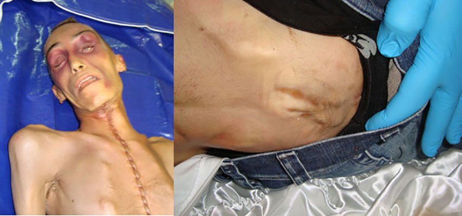 Caso Cucchi. I tre Carabinieri che lo arrestarono accusati di “omicidio preterintenzionale”