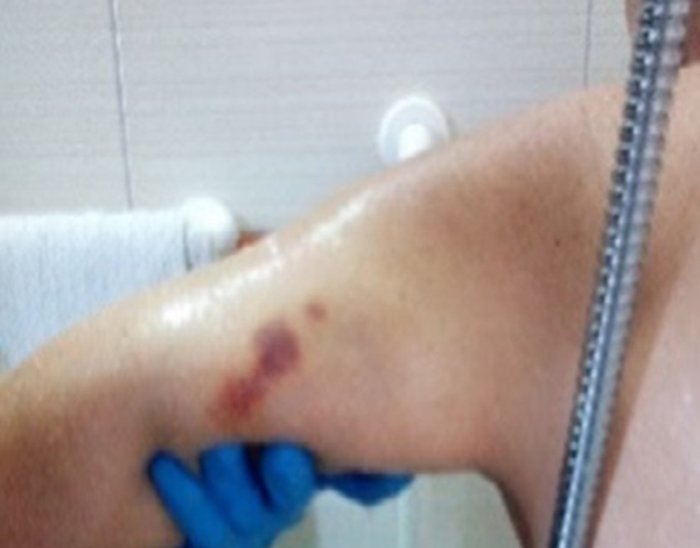 Casa di riposo lager a Oristano. Arrestata la titolare di Villa Rosina