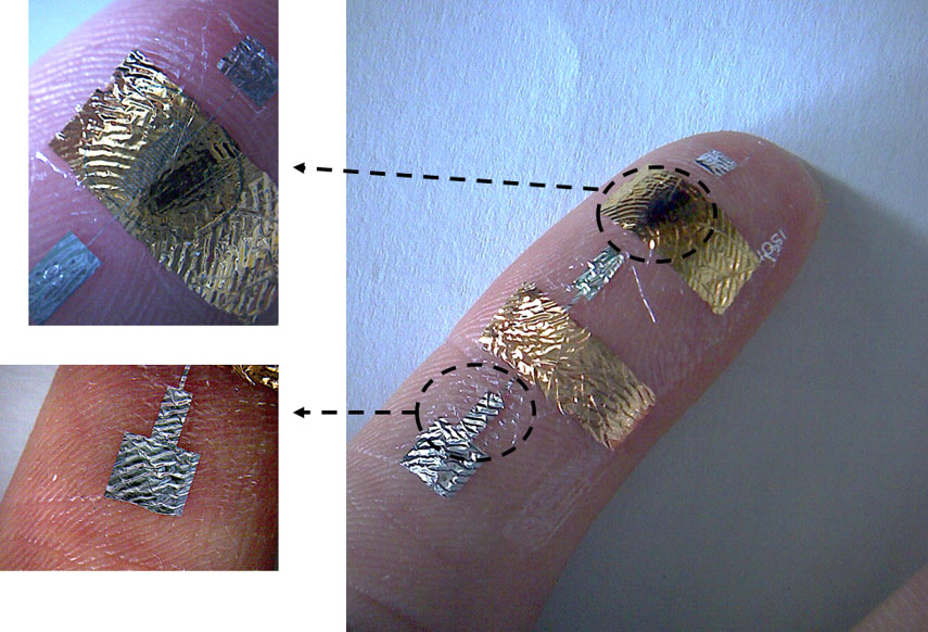 I progressi sullo studio della pelle artificiale arrivano dalla Sardegna: Mirabella ne parla in TV
