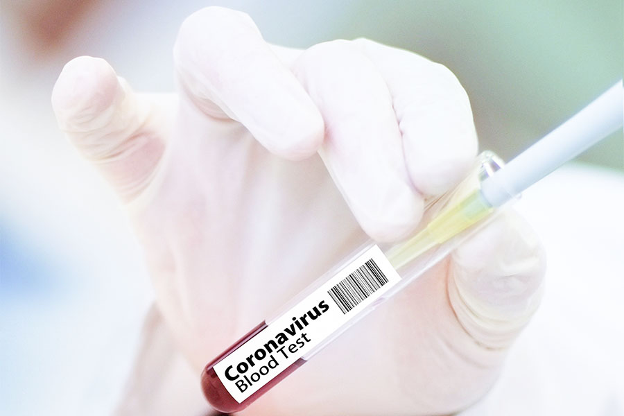 Covid. Gli esperti sperimentano la combinazione di più anticorpi contro le varianti del virus