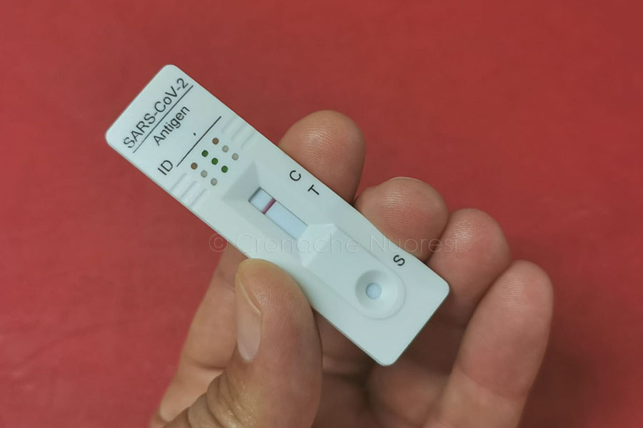 Covid. In Sardegna ancora sopra i mille i contagi ma calano ricoveri e decessi