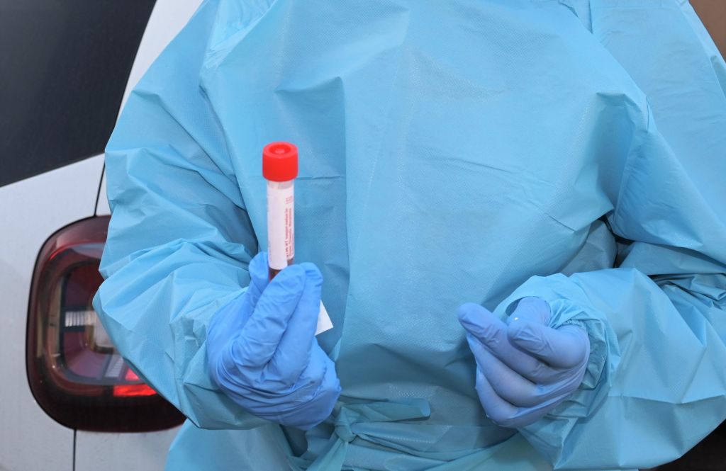 Covid, 17.155 i nuovi casi e 84 le vittime