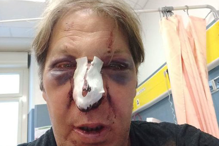 Il giornalista Antonello Lai pestato selvaggiamente in un locale a Cagliari: “A rischio la libertà di stampa”